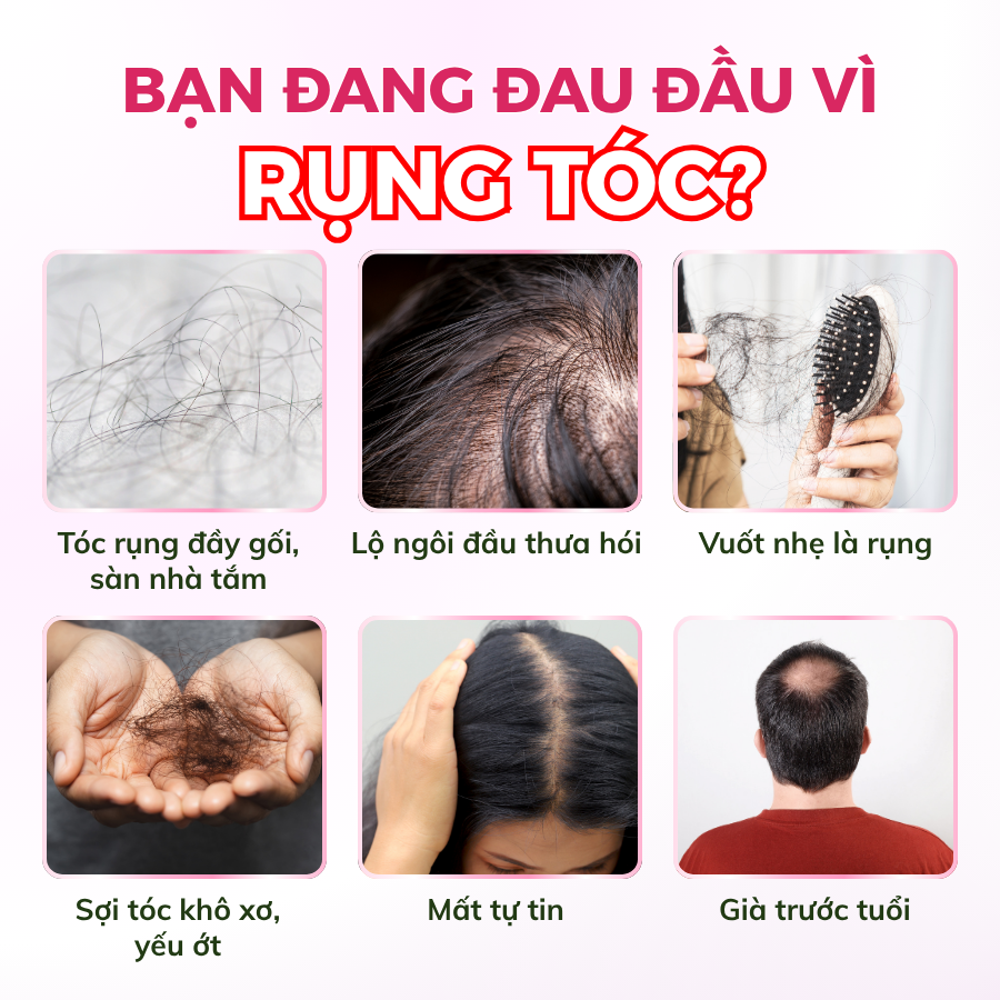 Dầu Gội Green Pharmacy Ngưu Bàng & Protein Lúa Mì 350ml - Giúp Tóc Chắc Khỏe, Giảm Gãy Rụng - Ảnh 5